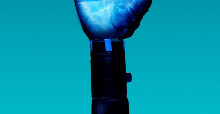 alt="Free Prosthetic Arm on Blue Background Stock Photo"